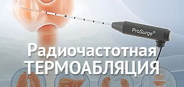 Радиочастотная абляция